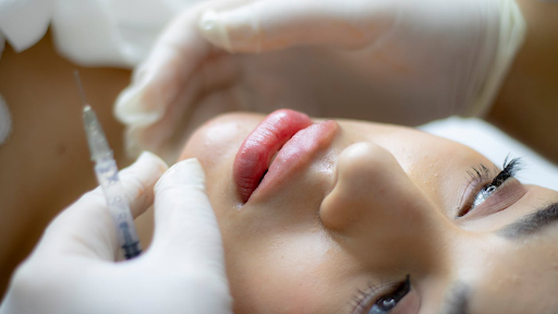 Key Advantages of Lip Filler Treatments for Natural Volume